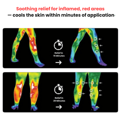 Vivenity™ ThermaRelief Knee Pro
